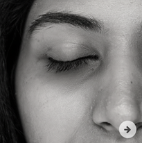 DARK CIRCLES