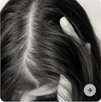 HAIR THINNING/LOSS
